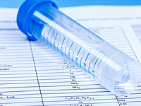 Wasseranalyse - Auswertung der Wasserprobe